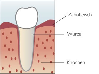 Zahn mit gesundem Zahnhalteapparat